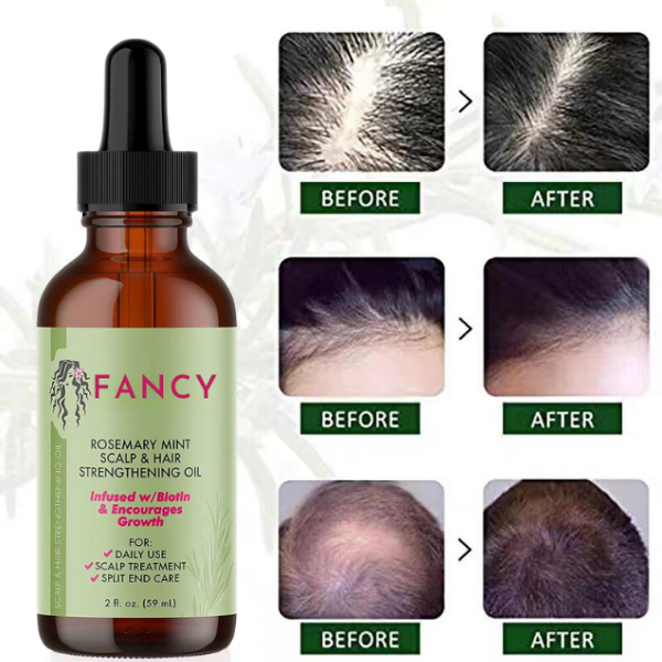 FANCY Rosemary Mint Hair Growth Oil