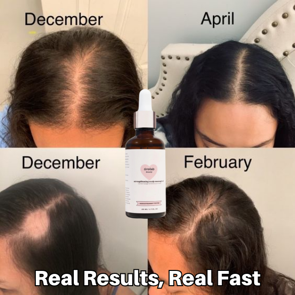 Grolab beauty Strengthening Scalp Massage Oil