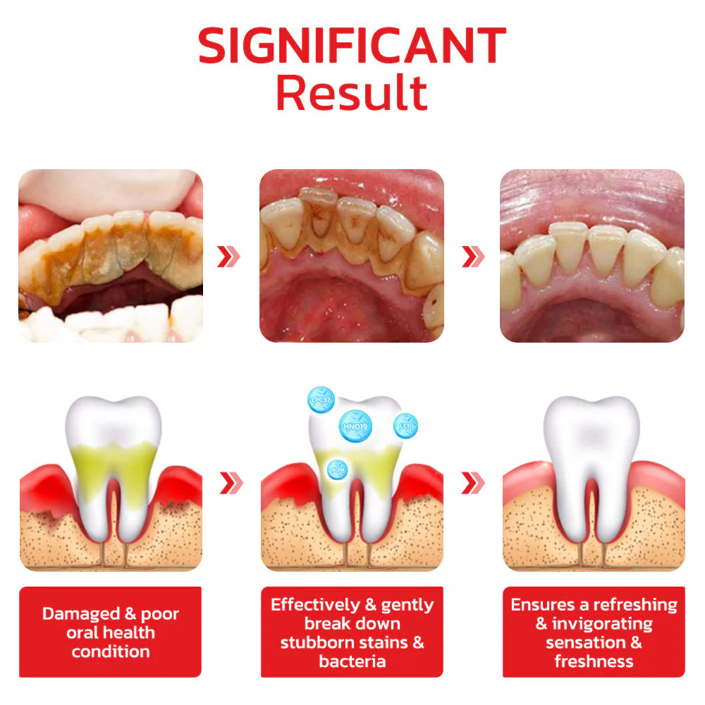 FANCY SP4 PROBIOTIC WHITENING TOOTHPASTE
