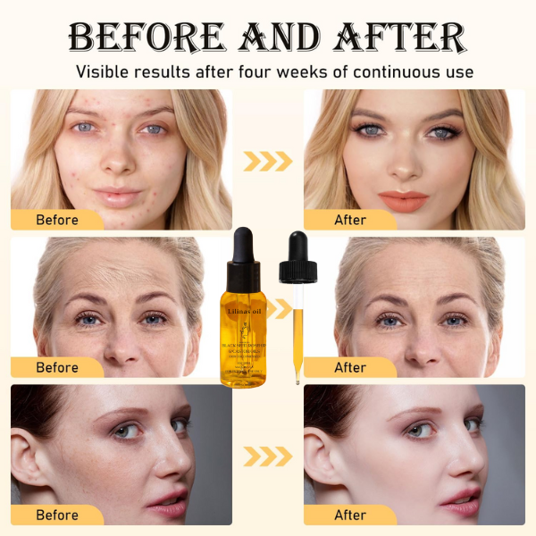 Lilinas oil  - BEAUTY GLOW